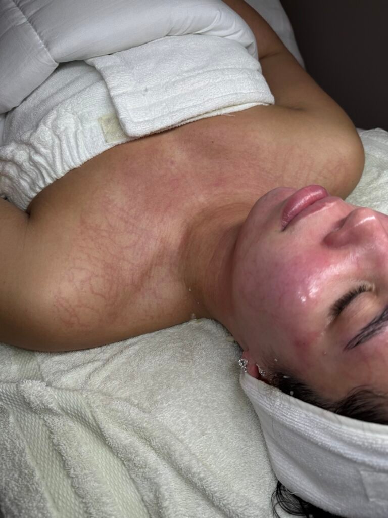dmk enzyme therapy plasmatic effect skin treatment