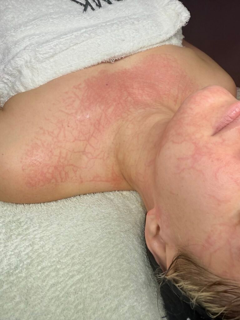 dmk enzyme therapy plasmatic effect skin treatment