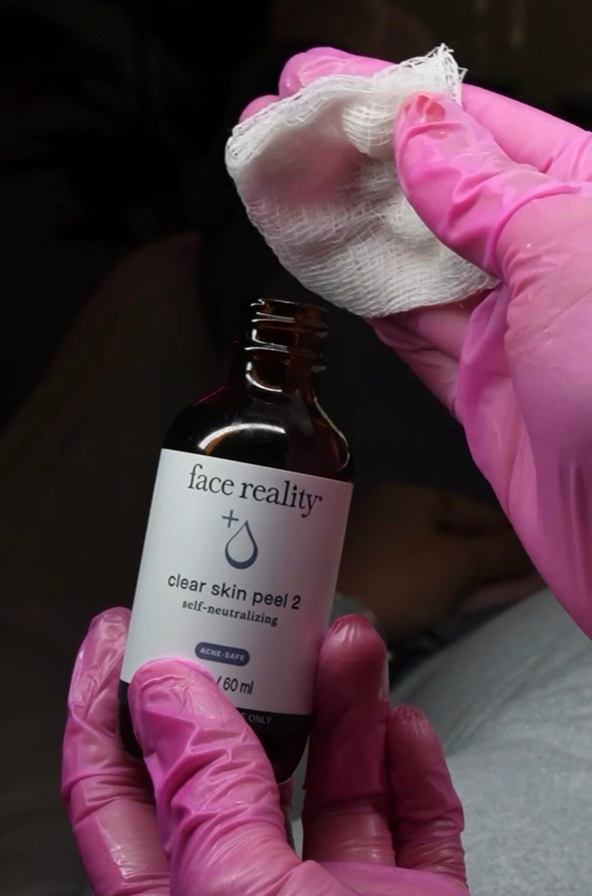 face reality acne bootcamp peel for acne prone skin